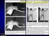 Two LECTURE on SCOLIOSIS in REGENSBURG / 10-14.05.2007