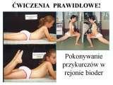 Plakaty. Edukacja. Nowe leczenie skolioz tzw. idiopatycznych.