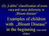 BLOUNT DISEASE/Golenie szpotawe/LECTURE/Knee Valgus Deformity/Prague/19.10.07
