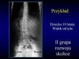Wody geotermalne w ortopedii. Geothermal water in orthopaedic therapy.