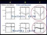 Wody geotermalne w ortopedii. Geothermal water in orthopaedic therapy. Acknowledgements: 