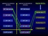 Wody geotermalne w ortopedii. Geothermal water in orthopaedic therapy. Najnowsza wiedza na temat KLASYFIKACJI SKOLIOZ w 