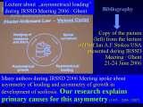RECENT fundamental KNOWLEDGE on SCOLIOSIS/Orthop.Congress/Cairo/Egypt/LECTURE