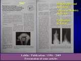 New Fundamental Knowledge on Scoliosis. SCIENCE versus OPINION / LECTURE