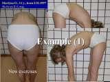 New Fundamental Knowledge on Scoliosis. SCIENCE versus OPINION / LECTURE