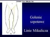 STANDING 'at free' on the right leg.Spine.Hip.Knee.Shank.LECTURE