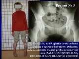 Test fleksyjny palc�w stopy / Flexions test of toes LECTURE