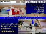 CEREBRAL PALSY, MPDZ / Mozgowe porazenie dziec. IZP. LECTURE
