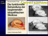 TWO LECTURES on scoliosis / Orthop.Congress in CAIRO-8.12.2006