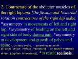Presentation of biomechanical etiology of so-called idiopathic scoliosis on 58 Orthopaedic Congress in Cairo/Egypt, 4th -9th December 2006.