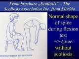 Presentation of biomechanical etiology of so-called idiopathic scoliosis on 58 Orthopaedic Congress in Cairo/Egypt, 4th -9th December 2006.