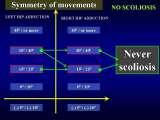 Presentation of biomechanical etiology of so-called idiopathic scoliosis on 58 Orthopaedic Congress in Cairo/Egypt, 4th -9th December 2006.