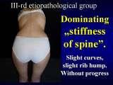 Presentation of biomechanical etiology of so-called idiopathic scoliosis on 58 Orthopaedic Congress in Cairo/Egypt, 4th -9th December 2006.
