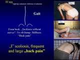 Presentation of biomechanical etiology of so-called idiopathic scoliosis on 58 Orthopaedic Congress in Cairo/Egypt, 4th -9th December 2006.