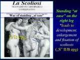 Presentation of biomechanical etiology of so-called idiopathic scoliosis on 58 Orthopaedic Congress in Cairo/Egypt, 4th -9th December 2006.