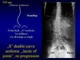 Presentation of biomechanical etiology of so-called idiopathic scoliosis on 58 Orthopaedic Congress in Cairo/Egypt, 4th -9th December 2006.