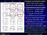Presentation of biomechanical etiology of so-called idiopathic scoliosis on 58 Orthopaedic Congress in Cairo/Egypt, 4th -9th December 2006.