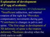 Presentation of biomechanical etiology of so-called idiopathic scoliosis on 58 Orthopaedic Congress in Cairo/Egypt, 4th -9th December 2006.