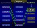 Presentation of biomechanical etiology of so-called idiopathic scoliosis on 58 Orthopaedic Congress in Cairo/Egypt, 4th -9th December 2006.