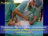 DDH/Cong.luxation of hip/LUBLIN method ot therapy/LECTURE