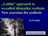 New Fundamental Knowledge on Scoliosis. SCIENCE versus OPINION / LECTURE