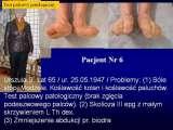 Test fleksyjny palców stopy / Flexions test of toes LECTURE
