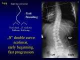 Presentation of biomechanical etiology of so-called idiopathic scoliosis on 58 Orthopaedic Congress in Cairo/Egypt, 4th -9th December 2006.
